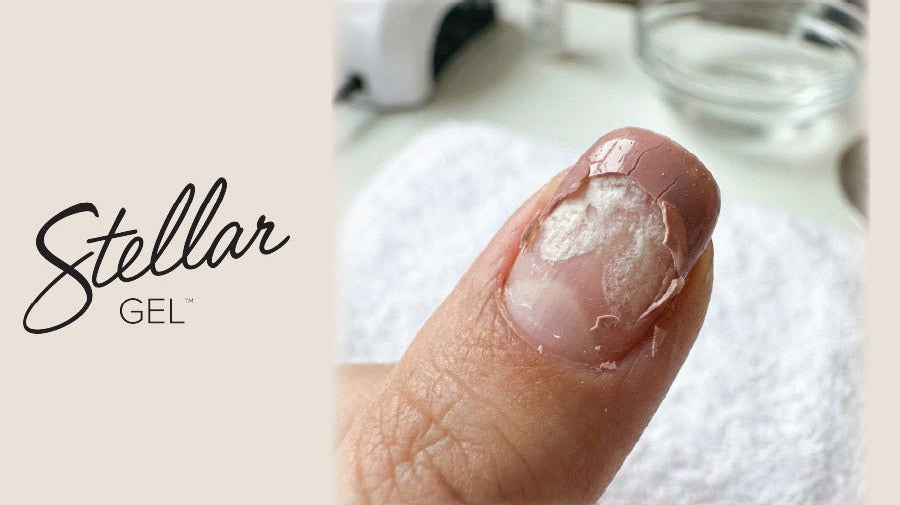 Acetone Science: Why It Melts Some Gels and Not Others - Stellar Gel™