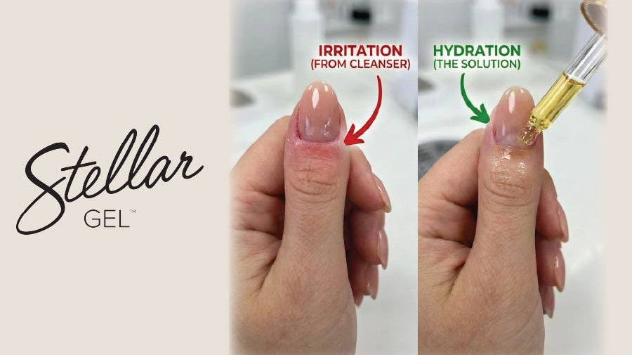 Redness Around the Cuticle? It Might Be Your Cleanser, Not the Gel. - Stellar Gel™