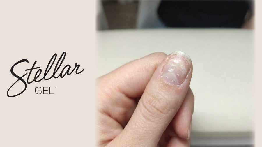 The Danger of Picking: Educating Clients on Mechanical Damage - Stellar Gel™