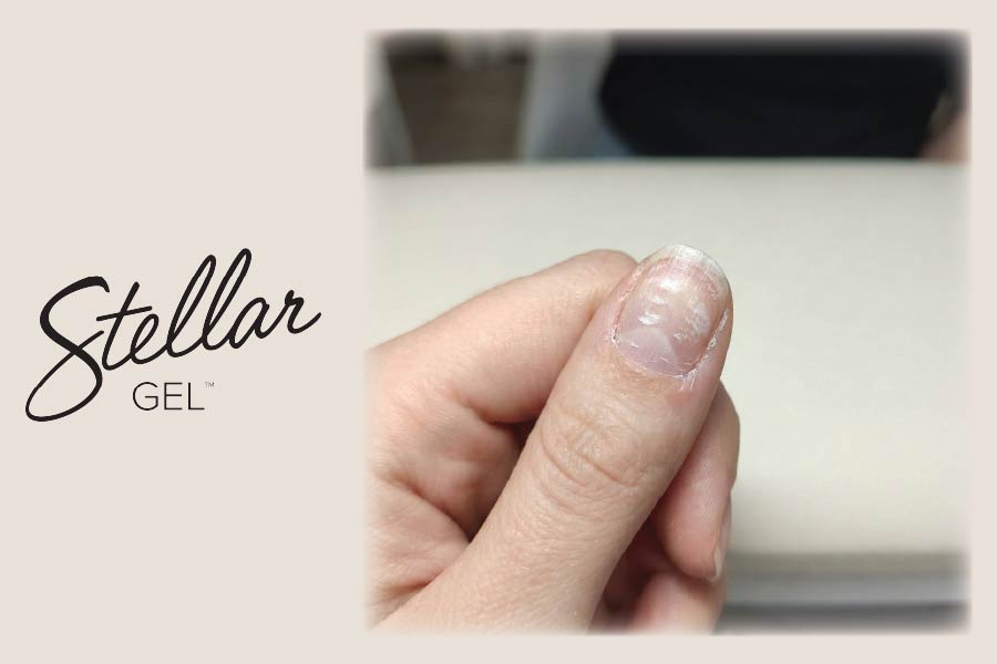 The Danger of Picking: Educating Clients on Mechanical Damage - Stellar Gel™